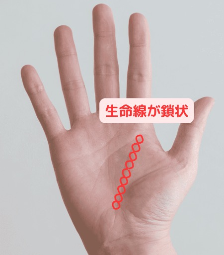 繊細な体質？鎖状の生命線には注意