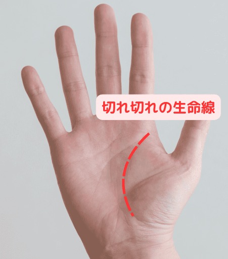 健康要注意！切れ切れの生命線