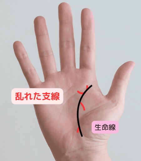 ストレスを示す乱れた支線