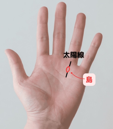 （3）なぜ評価されない？「太陽線に島がある」