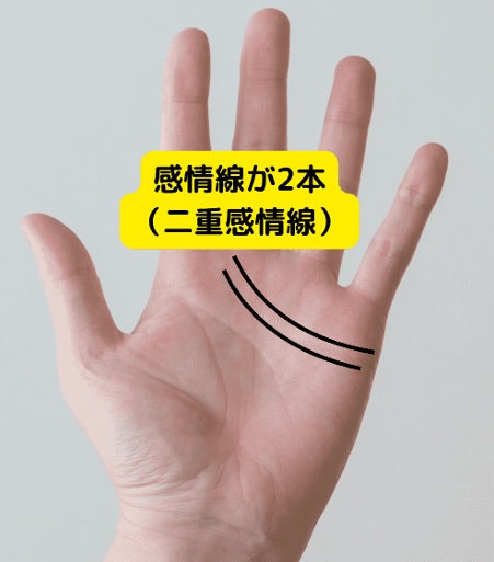 （9）愛が重すぎる？「感情線が2本（二重感情線）」