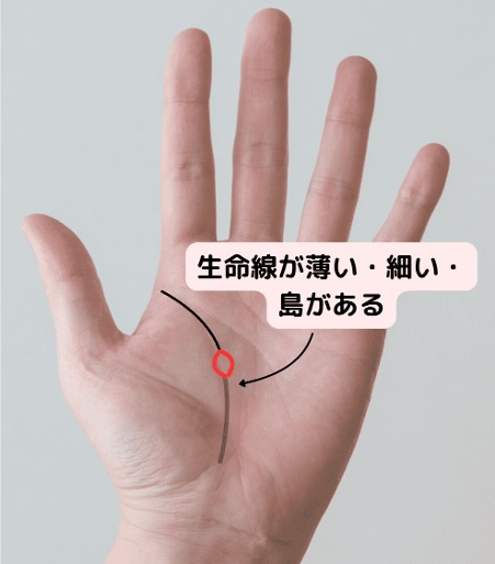 （20）体力低下！「生命線が薄い・細い・島がある」