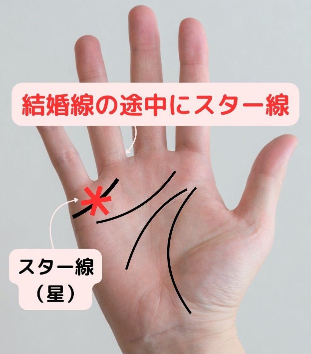 3位 結婚線の途中にスター線