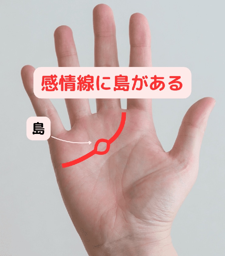 感情線に島がある