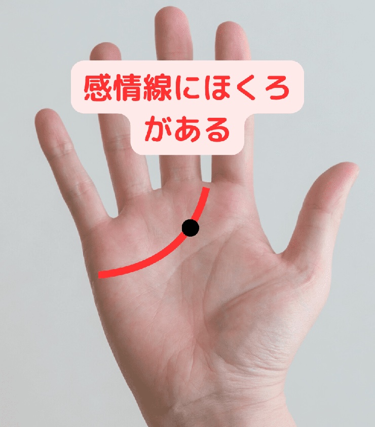 感情線にほくろがある